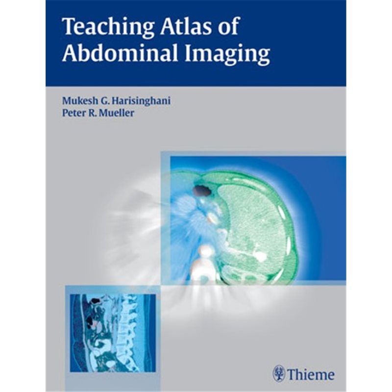 Teaching Atlas of Abdominal Imaging